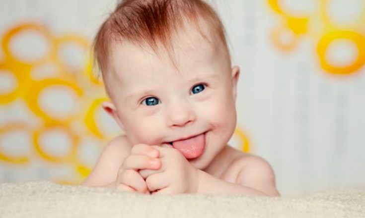 Bebê com Síndrome de Down sorri, de bruços, apoiado nas mãozinhas e mostrando a linguinha
